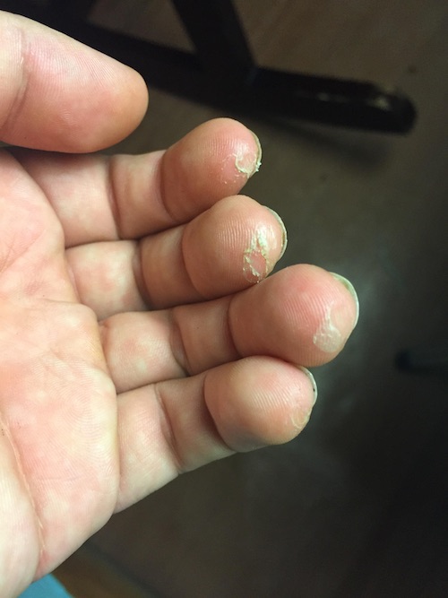 guitarist fingers